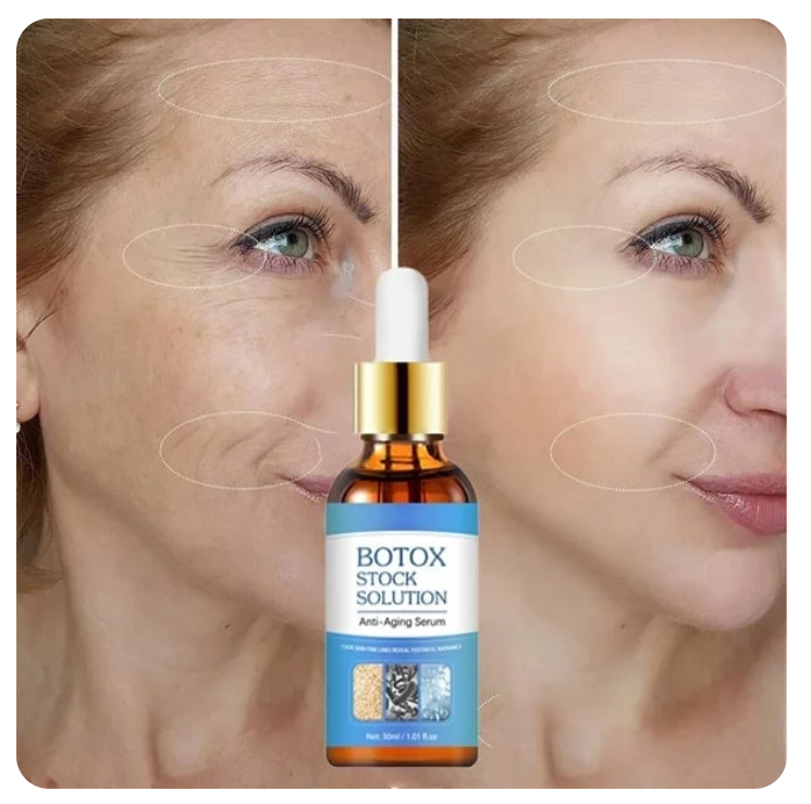💐 Last Day Discount 50% Off 💐 Botox Face Serum