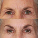Anti-wrinkle Magic Eye Cream - PlanetShopper
