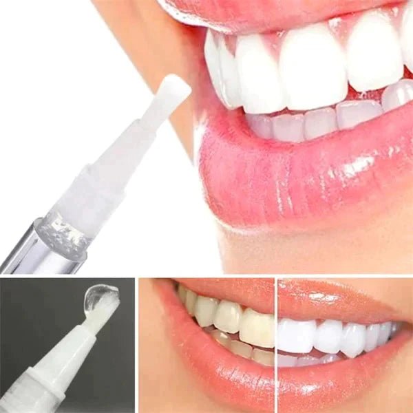 KaySmile™ Professional Teeth Whitening Pen - PlanetShopper