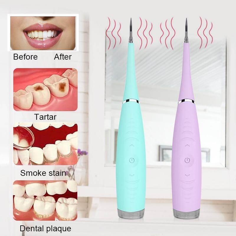 DentiCare™ - Ultrasonic Dental Cleaner