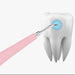 Ultrasonic Enamel Teeth Cleaning Tool - PlanetShopper